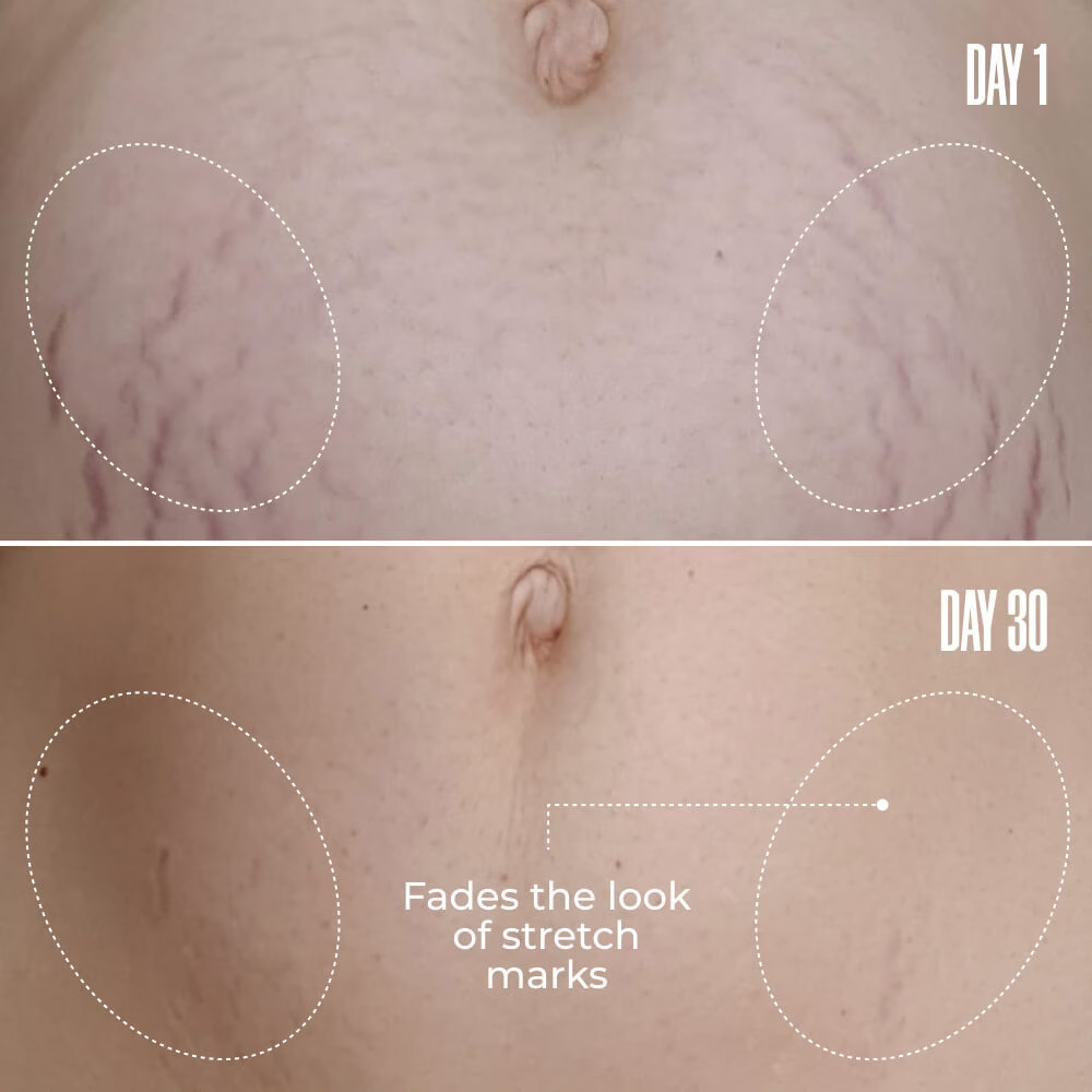 B-Flat Belly Firming Cream